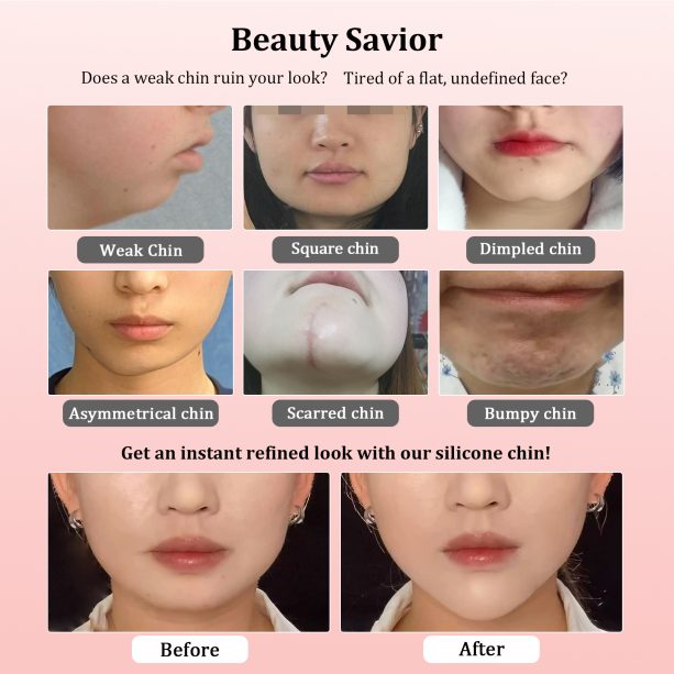 Fake Chin Soft 3D Silicone for Cosplay & Makeup - V-Shaped Jawline Enhancer, Anime SFX Prop，Instant Chin Lift for Face Contouring (Pointed Chin D) - 图片 2