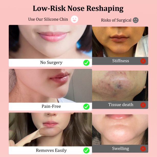 Fake Chin Soft 3D Silicone for Cosplay & Makeup - V-Shaped Jawline Enhancer, Anime SFX Prop，Instant Chin Lift for Face Contouring (Pointed Chin D) - 图片 3