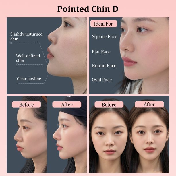 Fake Chin Soft 3D Silicone for Cosplay & Makeup - V-Shaped Jawline Enhancer, Anime SFX Prop，Instant Chin Lift for Face Contouring (Pointed Chin D) - 图片 5