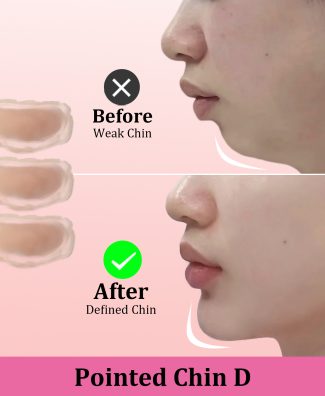 Fake Chin Soft 3D Silicone for Cosplay & Makeup - V-Shaped Jawline Enhancer, Anime SFX Prop，Instant Chin Lift for Face Contouring (Pointed Chin D)