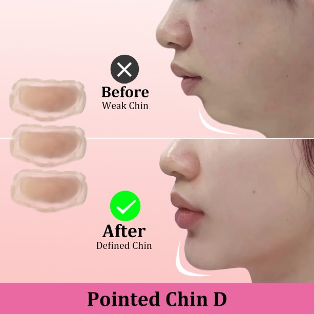 Fake Chin Soft 3D Silicone for Cosplay & Makeup - V-Shaped Jawline Enhancer, Anime SFX Prop，Instant Chin Lift for Face Contouring (Pointed Chin D)
